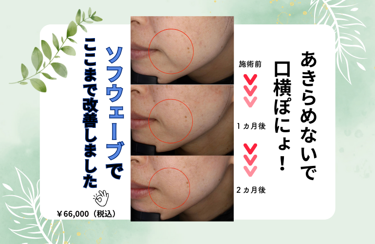 口横ぽにょソフウェの外観